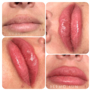 sweet-lips-31